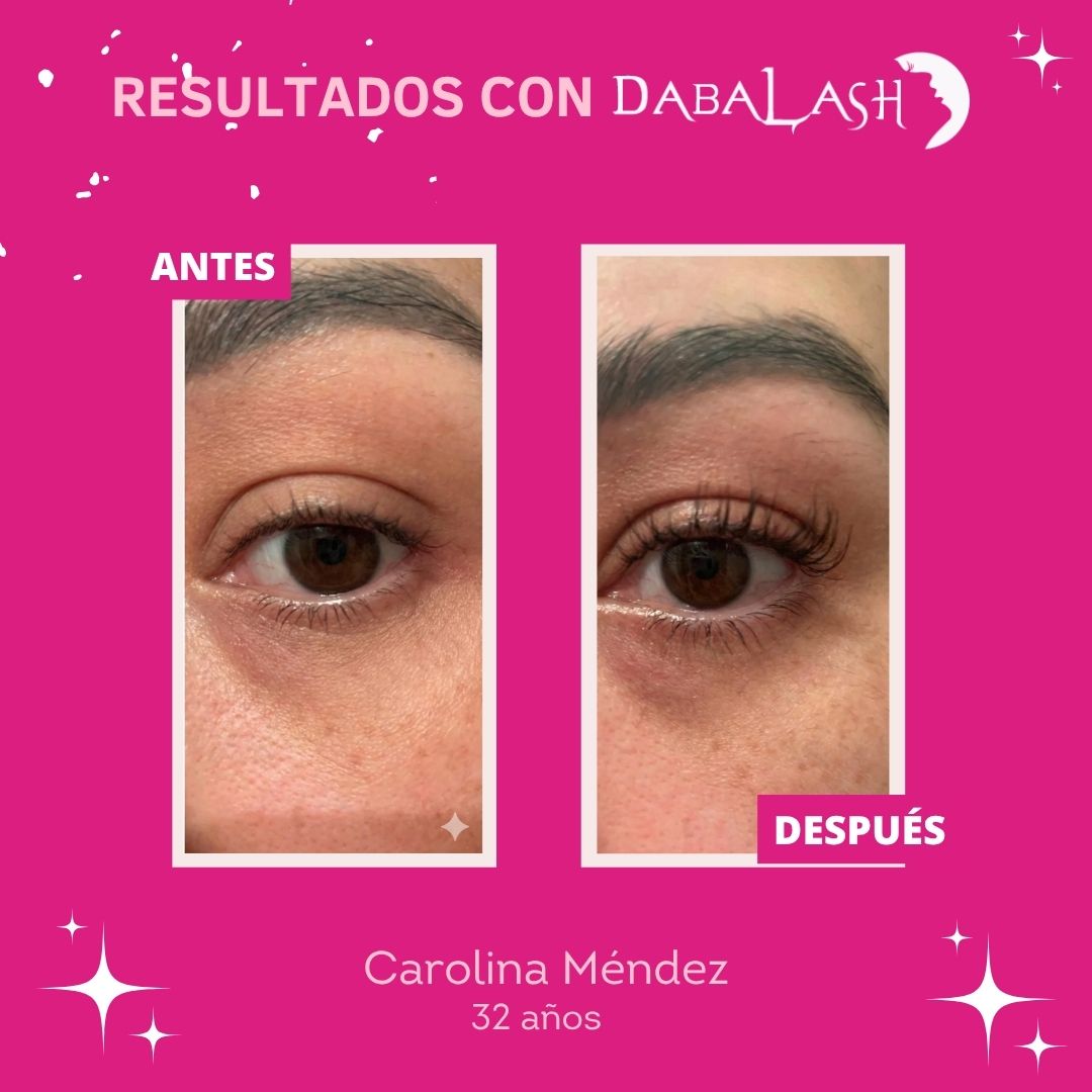 Testimonios de crecimiento de pesta&ntilde;as 